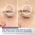 Masque LED Shark CryoGlow Lilas – Image 6